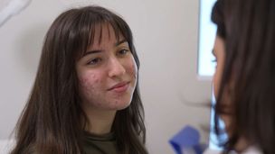 Acne e giovane età